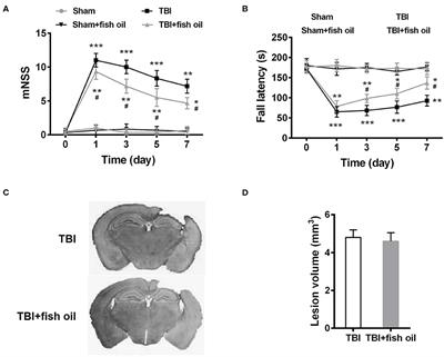 Omega-3 Polyunsaturated Fatty Acids Alleviate Traumatic Brain Injury by Regulating the Glymphatic Pathway in Mice